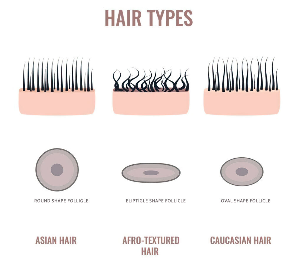 Different Hair Type-Asian Hair -Afro Hair- Caucasian Hair